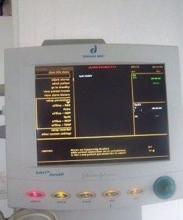 Johnson & Johnson Dinamap colored monitor  